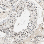 Immunohistochemical staining of human testis shows weak nuclear positivity in cells in seminiferous ducts.