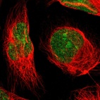 Immunofluorescent staining of human cell line U-2 OS shows localization to nucleus & nucleoli.