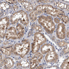 Immunohistochemical staining of human kidney shows moderate granular cytoplasmic positivity in cells in tubules.