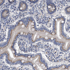 Immunohistochemical staining of human duodenum shows moderate granular cytoplasmic positivity in glandular cells.