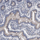 Immunohistochemical staining of human duodenum shows moderate granular cytoplasmic positivity in glandular cells.