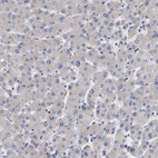 Immunohistochemical staining of human liver shows no positivity in hepatocytes as expected.