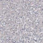Immunohistochemical staining of human liver shows no positivity in hepatocytes as expected.