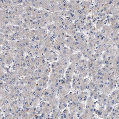Anti-MGAT4A Antibody