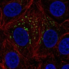Immunofluorescent staining of human cell line MCF7 shows localization to the Golgi apparatus.