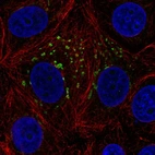 Immunofluorescent staining of human cell line MCF7 shows localization to the Golgi apparatus.