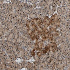 Anti-HECW1 Antibody