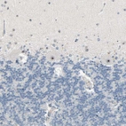Immunohistochemical staining of human cerebellum shows strong positivity in nucleoli in Purkinje cells.