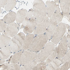 Immunohistochemical staining of human skeletal muscle shows no positivity in myocytes as expected.