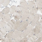 Immunohistochemical staining of human skeletal muscle shows no positivity in myocytes as expected.