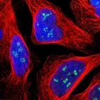 Immunofluorescent staining of human cell line U-2 OS shows positivity in nucleoli.