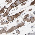 Anti-HIPK2 Antibody