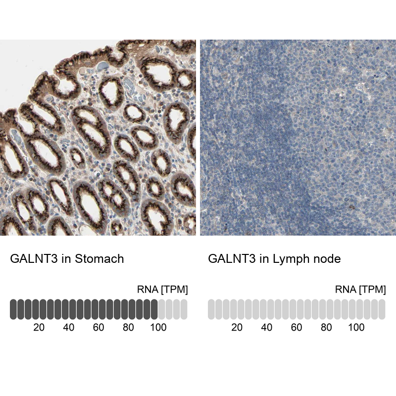 Anti-GALNT3 Antibody