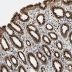 Immunohistochemical staining of human stomach shows high expression.