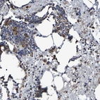 Anti-IL18R1 Antibody