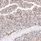 Immunohistochemical staining of human smal intestine shows strong membranous positivity in leukocytes.