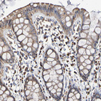 Immunohistochemical staining of human rectum shows moderate to strong membranous and cytoplasmic positivity in glandular and lymphoid cells.