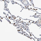 Immunohistochemical staining of human lung shows strong membranous and cytoplasmic positivity in macrophages.