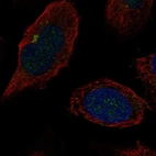 Anti-B4GALT2 Antibody
