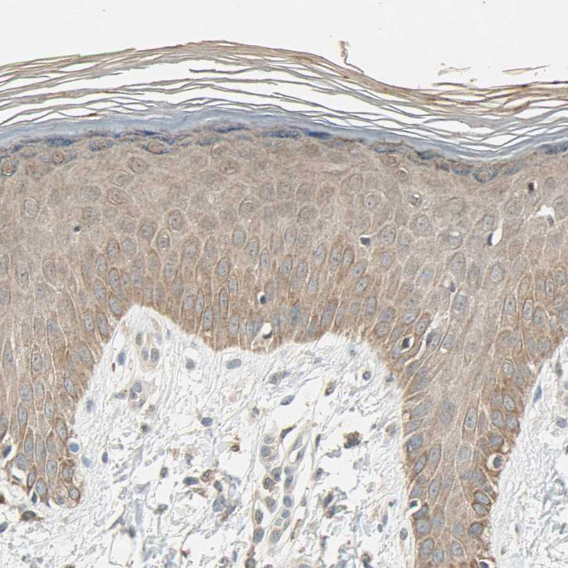 Anti-MAP3K7 Antibody