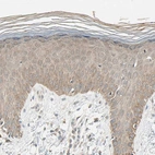 Anti-MAP3K7 Antibody