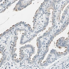 Immunohistochemical staining of human fallopian tube shows strong positivity in cilia in trophoblastic cells.