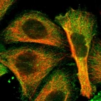 Immunofluorescent staining of human cell line A-431 shows localization to plasma membrane.