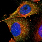 Immunofluorescent staining of human cell line U-251 MG shows localization to cytosol.