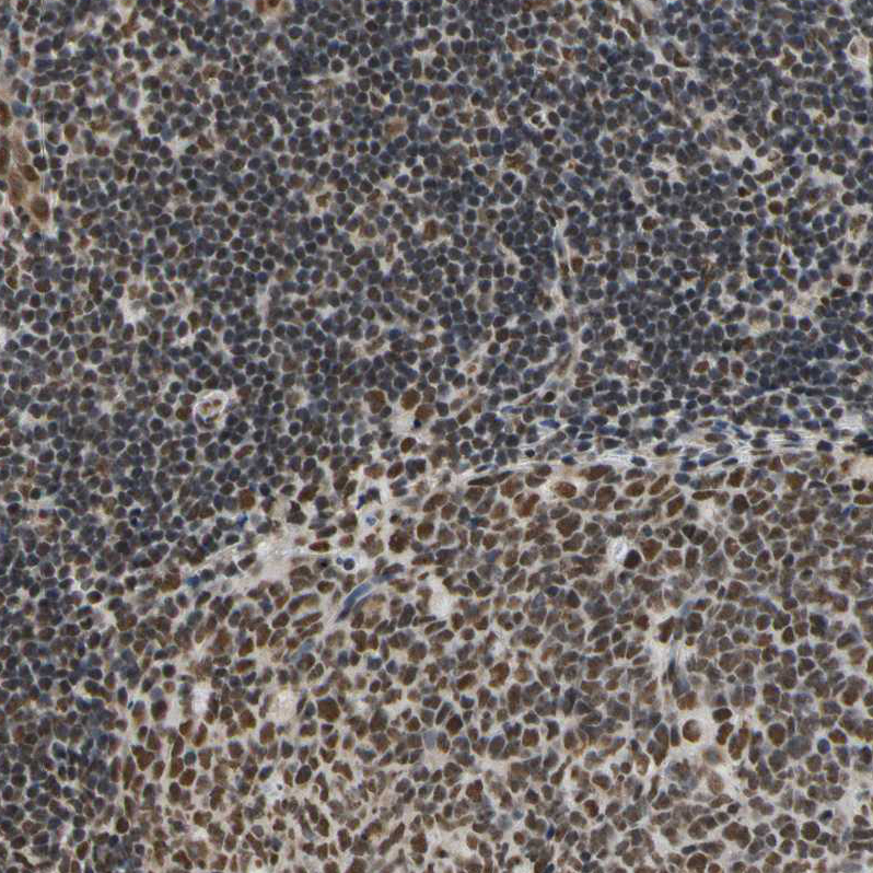 Anti-HNRNPK Antibody