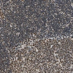 Anti-HNRNPK Antibody