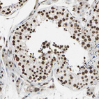 Immunohistochemical staining of human Testis shows strong nuclear positivity in cells in seminiferous ducts and Leydig cells.