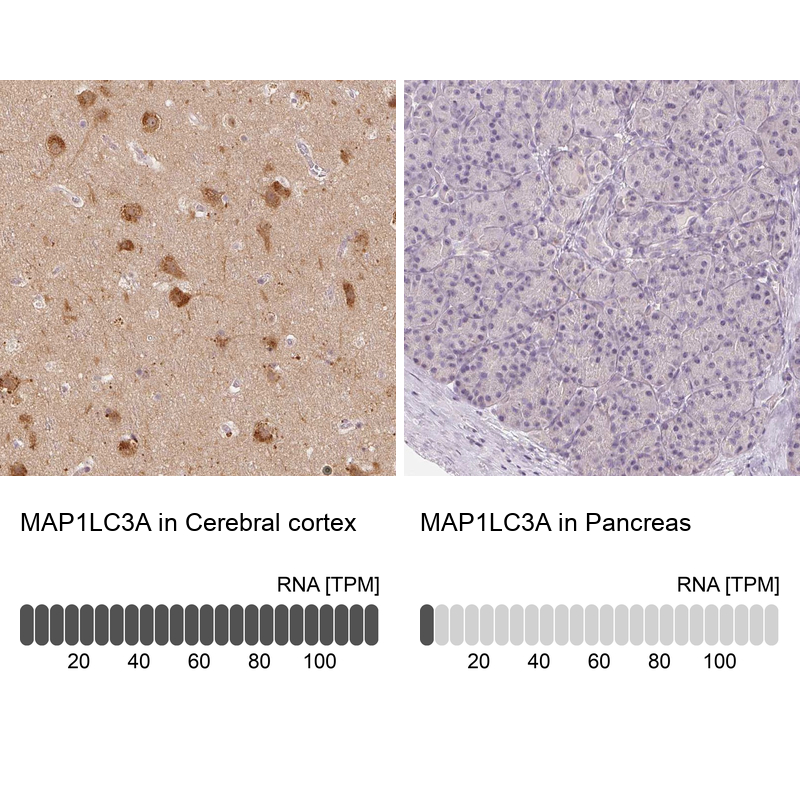 Anti-MAP1LC3A Antibody