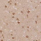 Immunohistochemical staining of human cerebral cortex shows high expression.