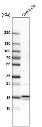 Western blot analysis in human cerebral cortex tissue.