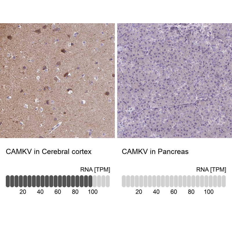 Anti-CAMKV Antibody