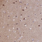 Immunohistochemical staining of human cerebral cortex shows high expression.
