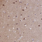 Immunohistochemical staining of human cerebral cortex shows high expression.