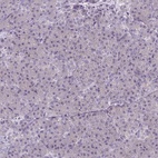 Immunohistochemical staining of human pancreas shows low expression as expected.