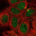 Immunofluorescent staining of human cell line CACO-2 shows localization to nucleoplasm & cytokinetic bridge.