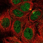 Immunofluorescent staining of human cell line CACO-2 shows localization to nucleoplasm & cytokinetic bridge.
