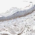 Immunohistochemical staining of human skin shows moderate cytoplasmic and membranous positivity in squamous epithelial cells.