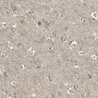 Immunohistochemical staining of human cerebral cortex shows no positivity in neurons as expected.