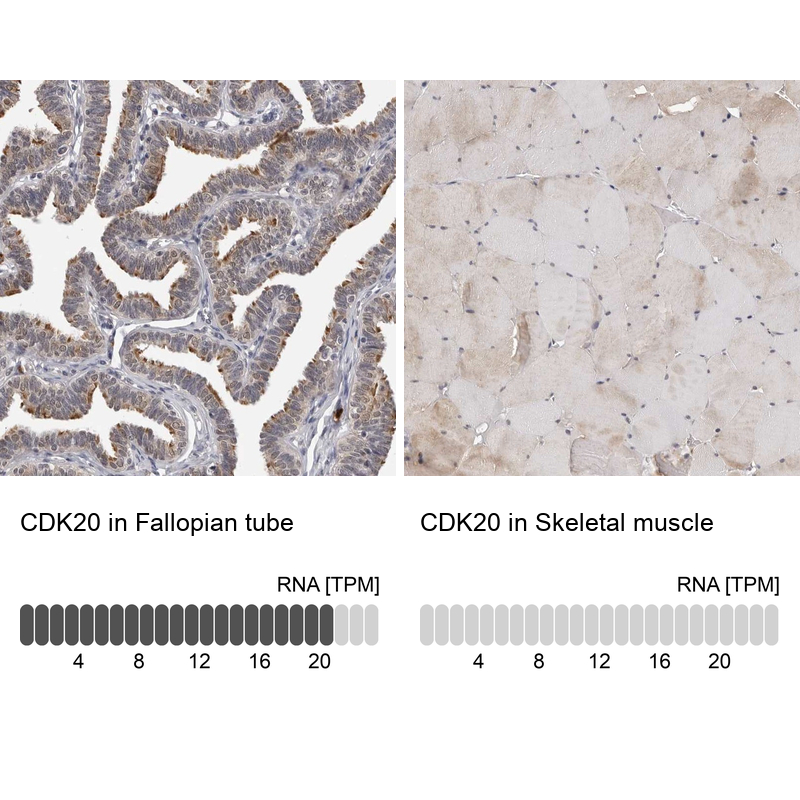 Anti-CDK20 Antibody