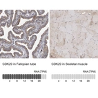 Anti-CDK20 Antibody
