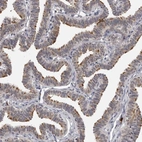 Immunohistochemical staining of human fallopian tube shows high expression.