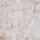 Immunohistochemical staining of human skeletal muscle shows low expression as expected.