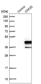 Western blot analysis in control (vector only transfected HEK293T lysate) and CDK20 over-expression lysate (Co-expressed with a C-terminal myc-DDK tag (~3.1 kDa) in mammalian HEK293T cells, LY421833).