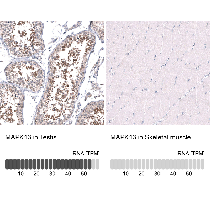 Anti-MAPK13 Antibody