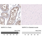 Anti-MAPK13 Antibody