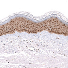 Immunohistochemical staining of human skin shows strong cytoplasmic and nuclear positivity in squamous epithelial cells.